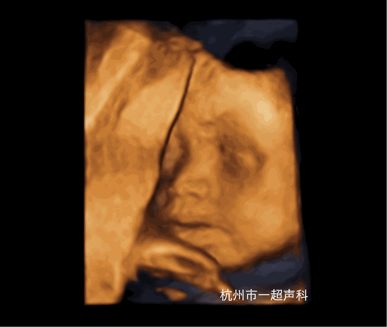 1608695660408170.gif 产前三维.gif